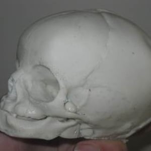 Skull Prop